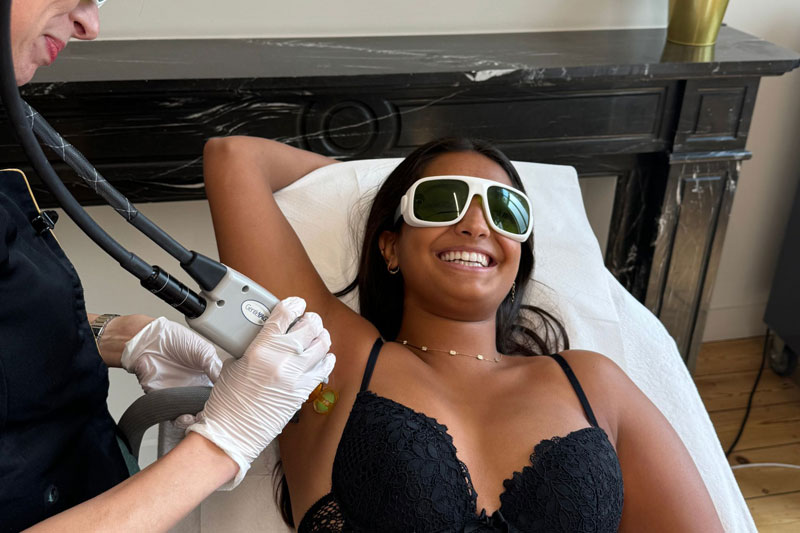 epilation laser peau foncee epilia mon1